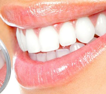 سفید کردن دندانها